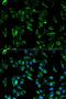 Tropomyosin 3 antibody, LS-B11912, Lifespan Biosciences, Immunofluorescence image 