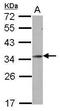 Homeobox protein goosecoid antibody, PA5-28380, Invitrogen Antibodies, Western Blot image 