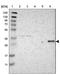 Major Histocompatibility Complex, Class II, DM Beta antibody, NBP1-85326, Novus Biologicals, Western Blot image 