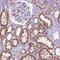 CAT2 antibody, HPA063175, Atlas Antibodies, Immunohistochemistry paraffin image 