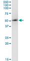 Armadillo Repeat Containing 6 antibody, MA5-22880, Invitrogen Antibodies, Immunoprecipitation image 