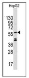 Angel Homolog 2 antibody, AP12382PU-N, Origene, Western Blot image 