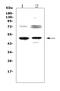 Fc Fragment Of IgE Receptor II antibody, PB9051, Boster Biological Technology, Western Blot image 