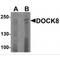 Dedicator of cytokinesis protein 8 antibody, TA349058, Origene, Western Blot image 
