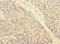 ATRN antibody, LS-C675406, Lifespan Biosciences, Immunohistochemistry paraffin image 