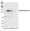 DNA Helicase B antibody, A304-686A, Bethyl Labs, Western Blot image 