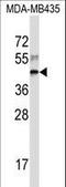 60S ribosomal protein L3 antibody, LS-C162709, Lifespan Biosciences, Western Blot image 
