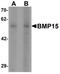 Bone morphogenetic protein 15 antibody, TA319774, Origene, Western Blot image 
