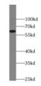 AHSG antibody, FNab03081, FineTest, Western Blot image 