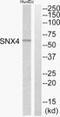 Sorting Nexin 4 antibody, PA5-39476, Invitrogen Antibodies, Western Blot image 