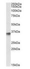 F-Box Protein 4 antibody, orb154557, Biorbyt, Western Blot image 