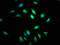 Ataxin 7 antibody, LS-C671705, Lifespan Biosciences, Immunofluorescence image 