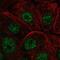 Immediate Early Response 2 antibody, NBP2-56845, Novus Biologicals, Immunofluorescence image 