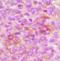 Insulin Like Growth Factor 2 Receptor antibody, orb393323, Biorbyt, Immunohistochemistry paraffin image 