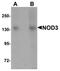 NLR Family CARD Domain Containing 3 antibody, orb75481, Biorbyt, Western Blot image 