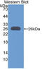 BCL9 Transcription Coactivator antibody, LS-C314981, Lifespan Biosciences, Western Blot image 
