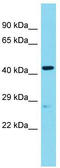 Angel Homolog 2 antibody, TA333520, Origene, Western Blot image 