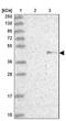 Zinc Finger Protein 239 antibody, NBP1-92620, Novus Biologicals, Western Blot image 