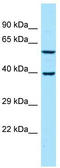 Dishevelled Binding Antagonist Of Beta Catenin 3 antibody, TA331392, Origene, Western Blot image 