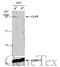 Caseinolytic Mitochondrial Matrix Peptidase Proteolytic Subunit antibody, GTX104656, GeneTex, Western Blot image 