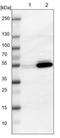 4-trimethylaminobutyraldehyde dehydrogenase antibody, NBP1-89150, Novus Biologicals, Western Blot image 