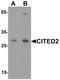 MRG-1 antibody, PA5-34462, Invitrogen Antibodies, Western Blot image 