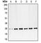 Platelet Derived Growth Factor Subunit B antibody, LS-C352642, Lifespan Biosciences, Western Blot image 