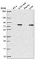 Glycerol-3-Phosphate Acyltransferase, Mitochondrial antibody, HPA060090, Atlas Antibodies, Western Blot image 