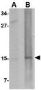 Nanos C2HC-Type Zinc Finger 2 antibody, GTX85391, GeneTex, Western Blot image 
