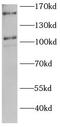 Hypoxia Up-Regulated 1 antibody, FNab10247, FineTest, Western Blot image 