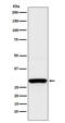Aly/REF Export Factor antibody, M03580, Boster Biological Technology, Western Blot image 