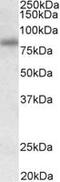 Serologically Defined Colon Cancer Antigen 8 antibody, MBS422897, MyBioSource, Western Blot image 