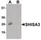 Shisa Family Member 3 antibody, PA5-34527, Invitrogen Antibodies, Western Blot image 