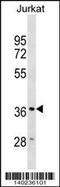 Heme oxygenase 2 antibody, 60-469, ProSci, Western Blot image 