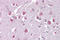 ETV1 antibody, ARP38528_P050, Aviva Systems Biology, Immunohistochemistry paraffin image 