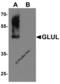 Glutamate-Ammonia Ligase antibody, PM-7209, ProSci, Western Blot image 