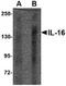Pro-interleukin-16 antibody, TA306713, Origene, Western Blot image 