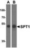 Spt1 antibody, NBP2-81928, Novus Biologicals, Western Blot image 