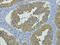 Keratin 19 antibody, STJ96953, St John