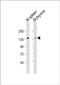 Serine/Threonine Kinase 10 antibody, PA5-48704, Invitrogen Antibodies, Western Blot image 