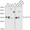 Sulfotransferase Family 1A Member 3 antibody, GTX66101, GeneTex, Western Blot image 