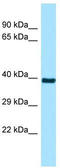 Radial Spoke Head 9 Homolog antibody, TA334370, Origene, Western Blot image 
