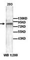 DAN Domain BMP Antagonist Family Member 5 antibody, orb77295, Biorbyt, Western Blot image 