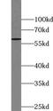60 kDa SS-A/Ro ribonucleoprotein antibody, FNab09012, FineTest, Western Blot image 