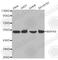 Mitogen-Activated Protein Kinase 8 antibody, A6117, ABclonal Technology, Western Blot image 