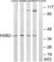 Homeobox B2 antibody, LS-C120044, Lifespan Biosciences, Western Blot image 