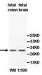 Intercellular adhesion molecule 4 antibody, orb77922, Biorbyt, Western Blot image 