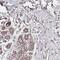 B-cell CLL/lymphoma 9-like protein antibody, PA5-61946, Invitrogen Antibodies, Immunohistochemistry paraffin image 