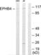 EPH Receptor B4 antibody, LS-C118944, Lifespan Biosciences, Western Blot image 