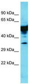 Keratin 35 antibody, TA332275, Origene, Western Blot image 